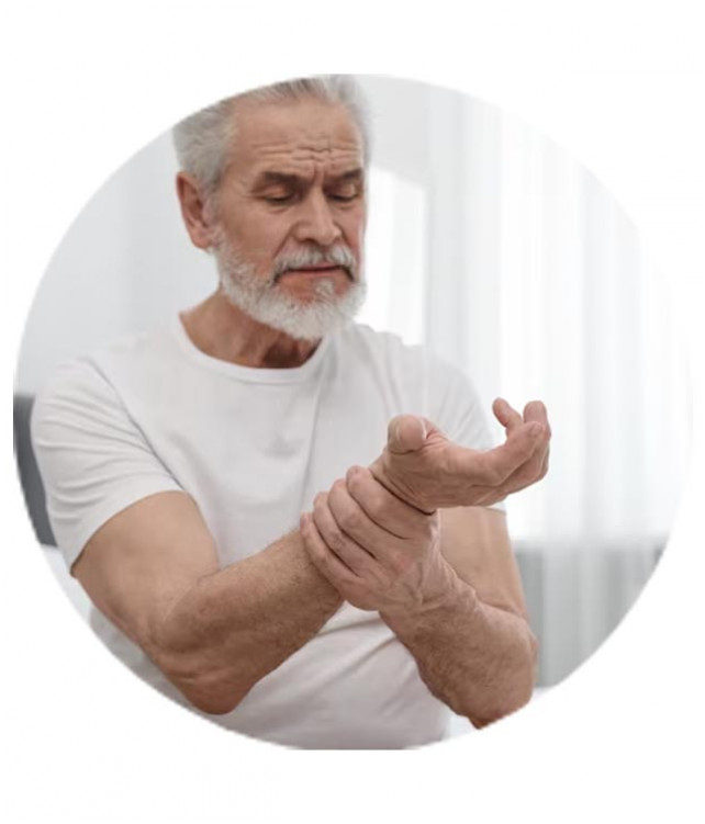 Arthritis Wrist Pain